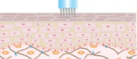 マイクロホイールを開ける