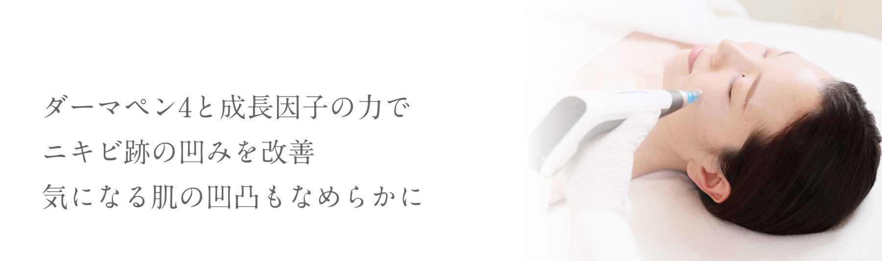 ダーマペン4と成長因子の力でニキビ跡の凹みを改善気になる肌の凹凸もなめらかに