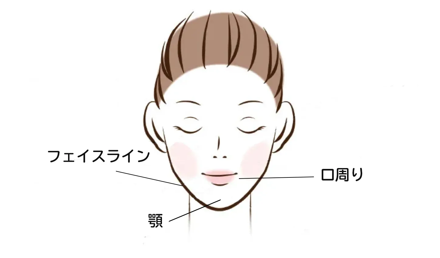 生理前・生理中にニキビが発生しやすい場所