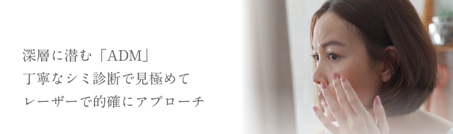深層に潜む「ADM」丁寧なシミ診断で見極めてレーザーで的確にアプローチ