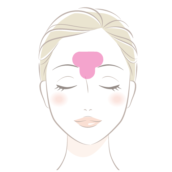 眉間ニキビの症状