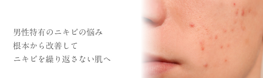 男性特有のニキビの悩み根本から改善してニキビを繰り返さない肌へ