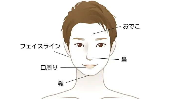 ニキビ・ニキビ跡が発生しやすい場所