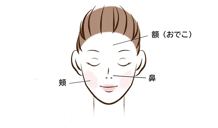 産後のシミが発生しやすい場所（顔）