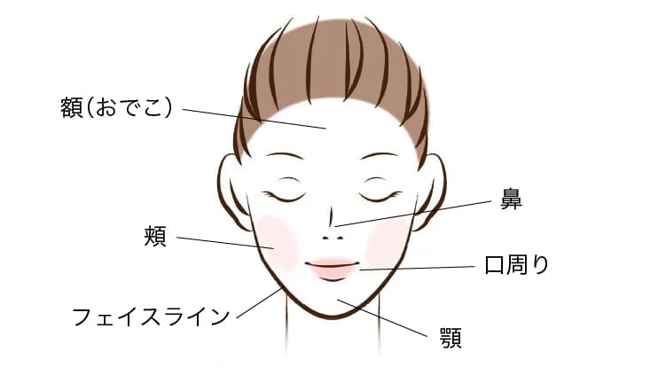 赤ニキビが発生しやすい場所