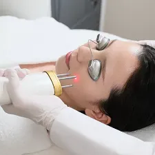 ピコレーザー［美肌ピコフラクショナル］